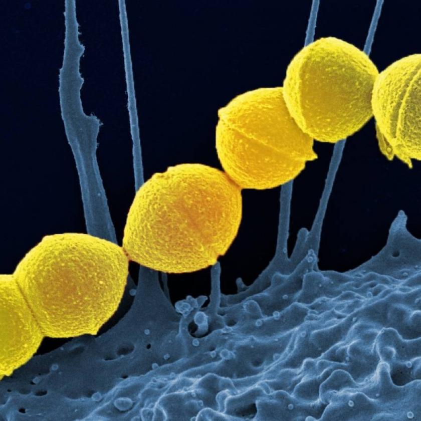 Húsevő baktérium szedi százával áldozatait Japánban