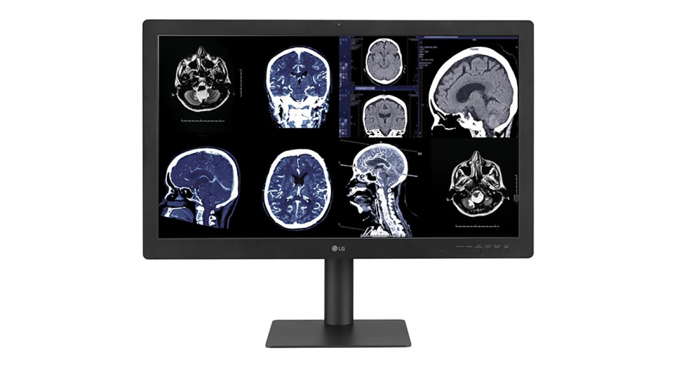 Megérkezett az LG első, IPS Black technológiával készülő diagnosztikai monitora 