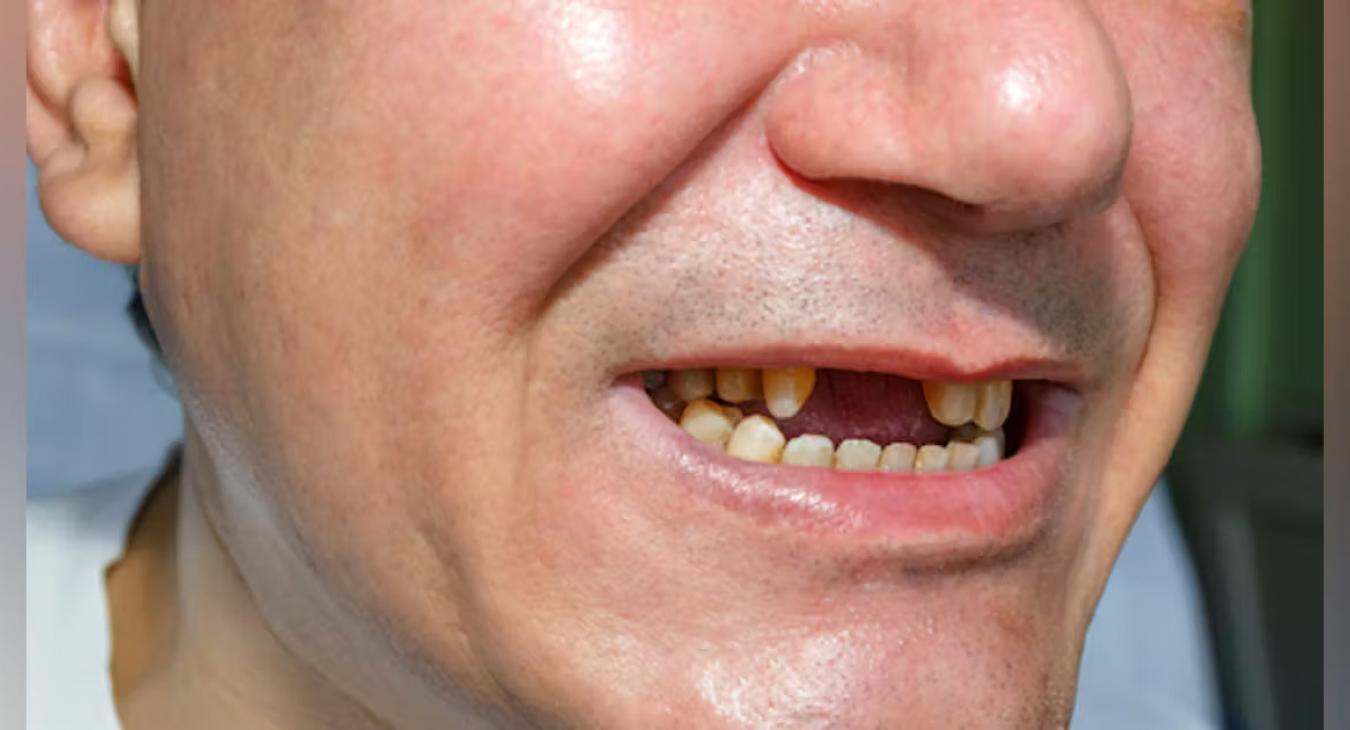 Forradalmi jelentőségű gyógyszert fejlesztenek a japán orvosok 