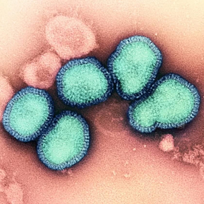 Fajokon átívelő, kombinált típusú madárinfluenzában halt meg egy nő