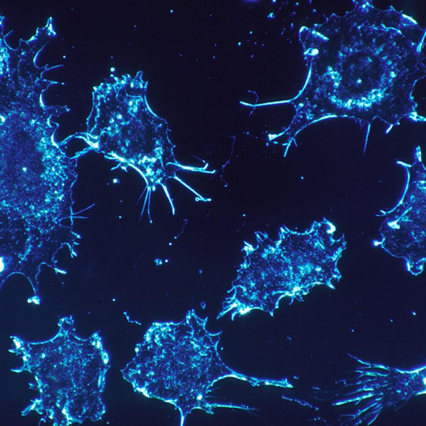 A daganatos sejtek 99%-át elpusztította egy új rákterápia